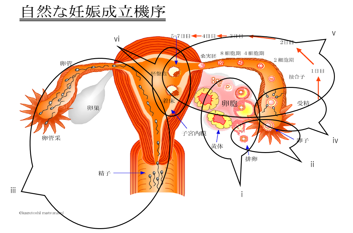 不妊の原因
